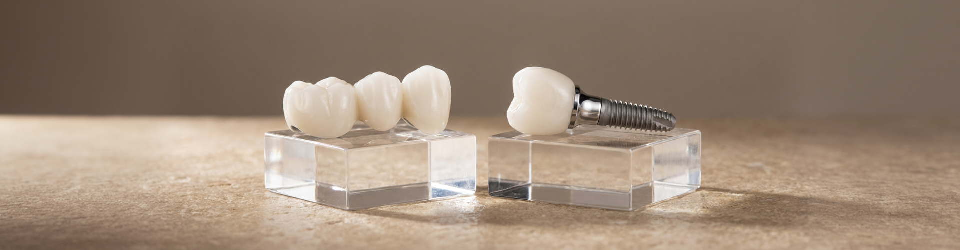A three-tooth dental bridge and a single dental implant with a metal screw displayed on clear stands side by side.